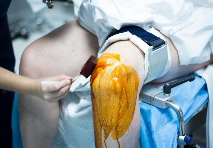 Dezinfekce operačního pole je důležitou součástí artroskopie kolene