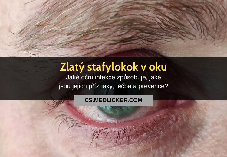 Jaké oční infekce způsobuje zlatý stafylokok? Příznaky, léčba a prevence!