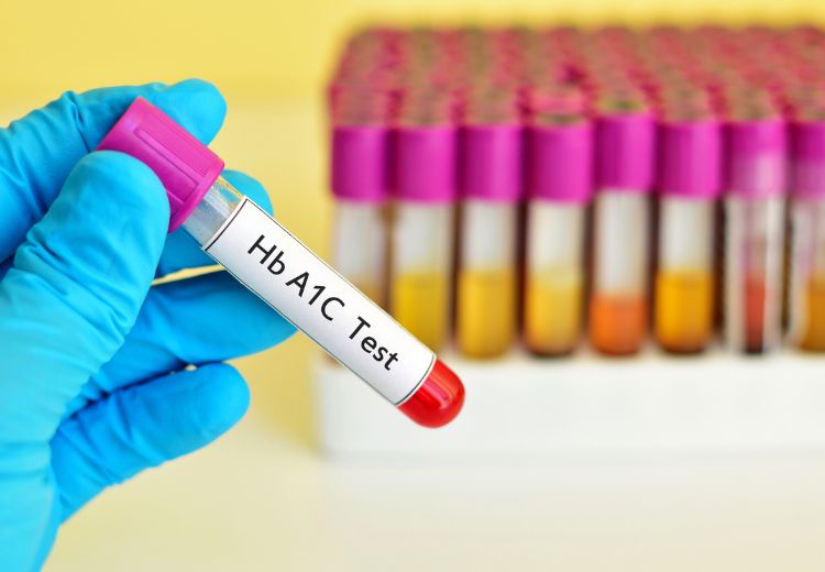 Hodnoty HbA1c se měří jednou až několikrát za rok, v závislosti na způsobu léčby diabetu a jeho kompenzaci